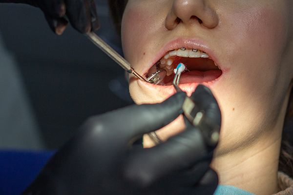 How To Select The Right Orthodontist Near Me